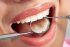 Конкурс на лучшего стоматологического гигиениста состоится в Нижнем Новгороде.